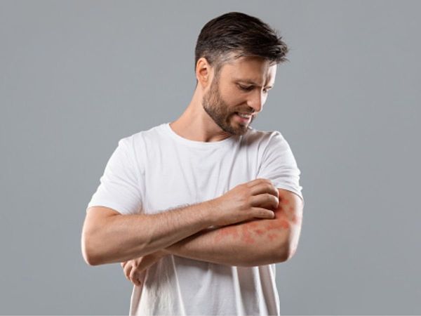 Remedies for Fungal Infection