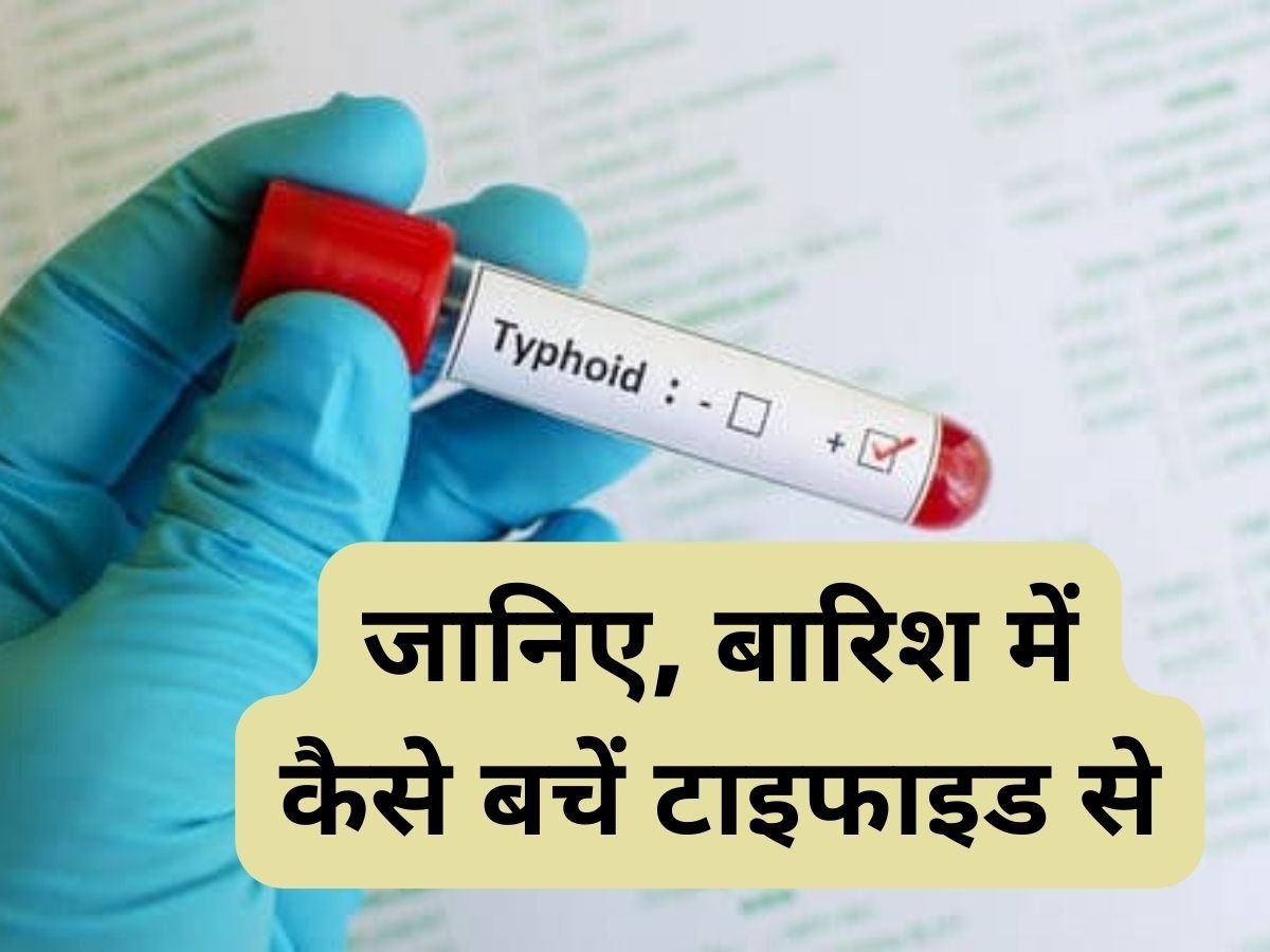 Typhoid: Typhoid Monsoon Tips Beware of typhoid during the rainy season