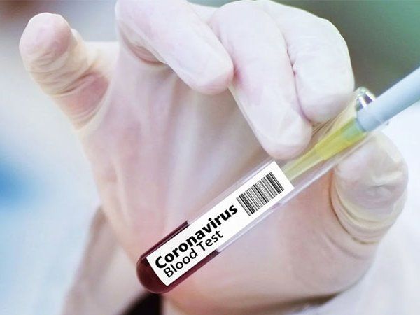 Oxford University Corona Vaccine: कोविड-19 वैक्सीन फेस-1 परीक्षण डेटा 20 जुलाई को होगा जारी