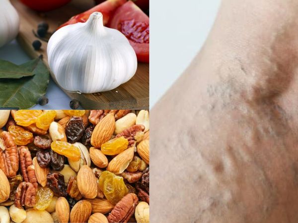 Tips to remove Veins blockage