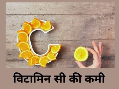 Deficiency Of Vitamin C Deficiency Of Vitamin C