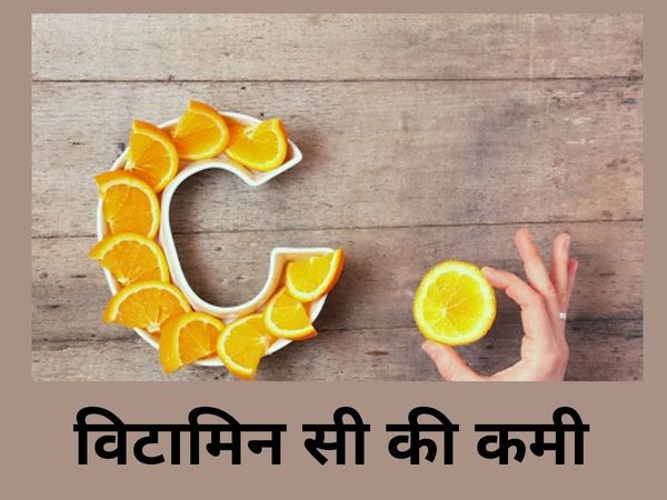 Deficiency Of Vitamin C