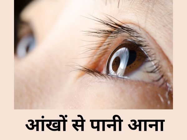 Remedies for Watery Eyes