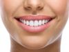 White Teeth Home Remedies Tips