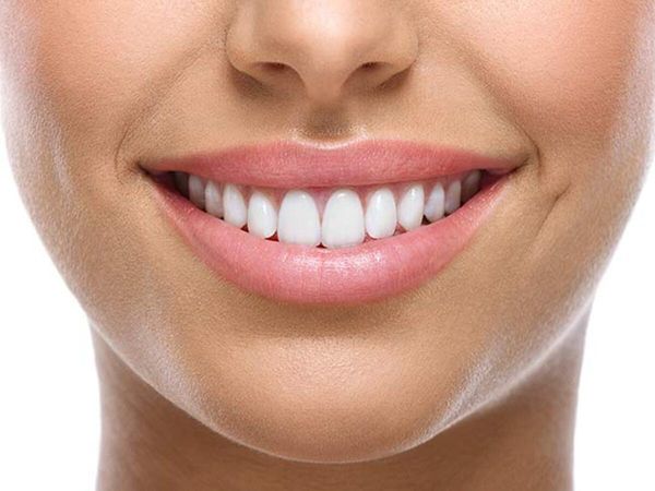 White Teeth Home Remedies Tips