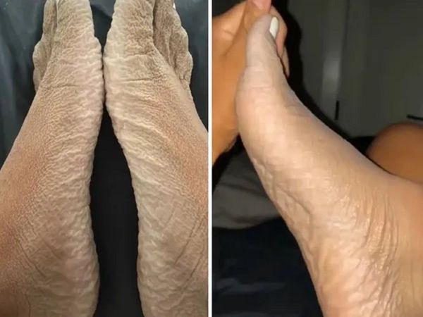 Woman shares gross footage after her 16-hour 'accidental' bath, seeks help online