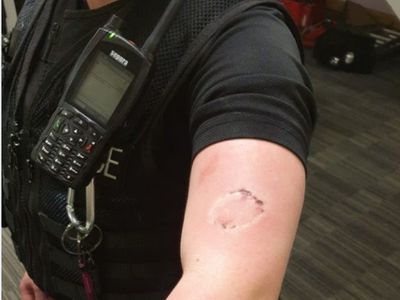 Women police officer bitten while enforcing lock down Women police officer bitten while enforcing lock down