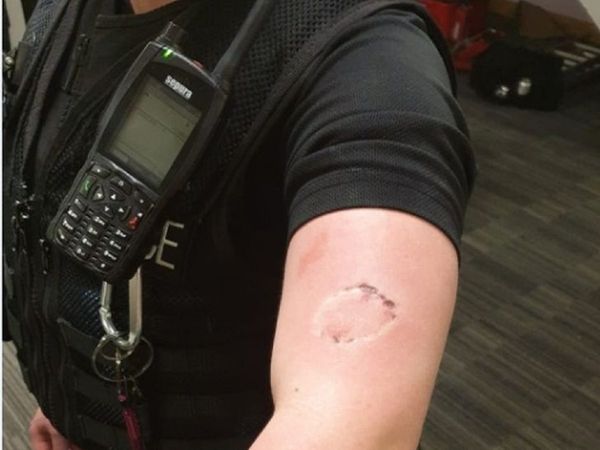 Women police officer bitten while enforcing lock down