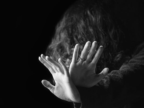 Doubt on wife's character, husband threw acid on her face, the woman badly burnt