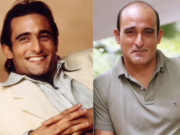 Akshaye Khanna, Koffee With Karan, kshaye Khanna, Bollywood, Hairfall problem, Premature baldness, 