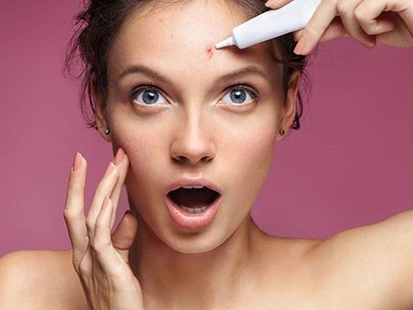Tips to get rid of acne