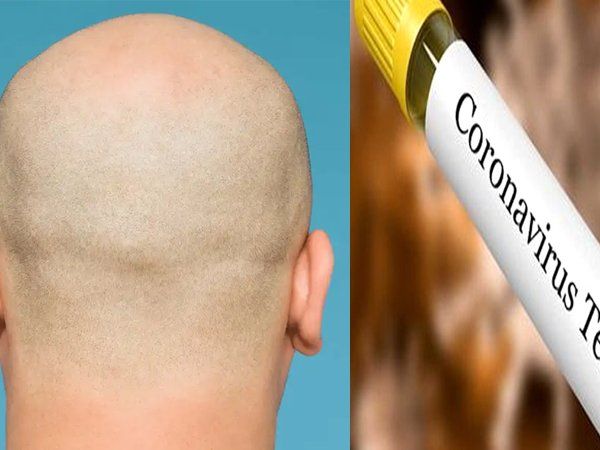 Representational Image