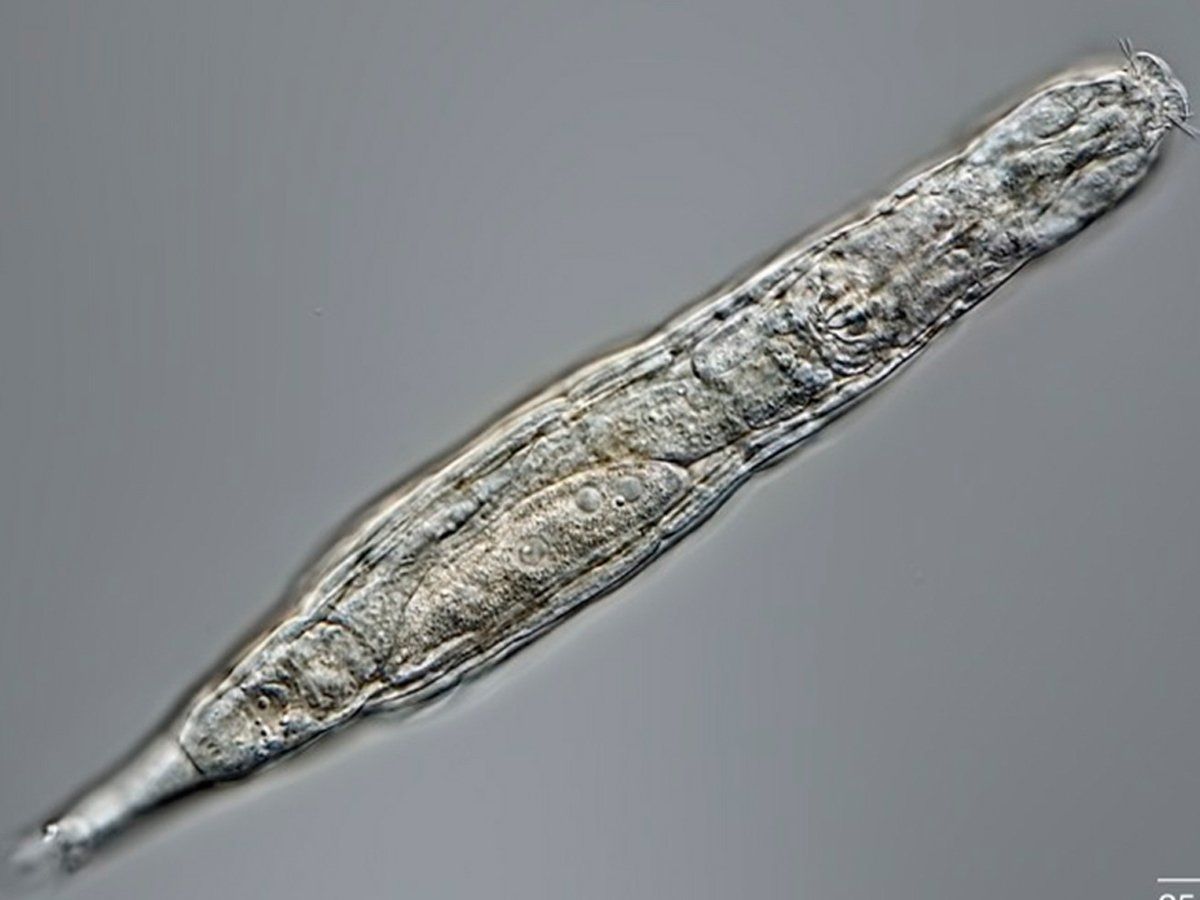 Bedeloid rotifers : साइबेरिया की बर्फ में 24 हजार वर्षों तक सोया रहा यह जीव, जाग गया अब