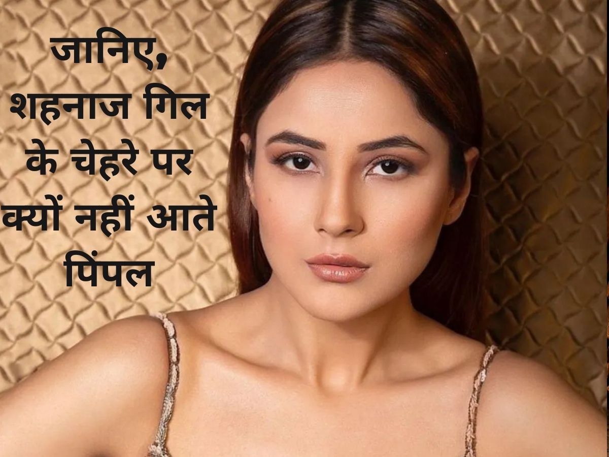 Beauty Tips: पिंपल्स व मुंहासे से मिलेगा छुटकारा, अपनाएं शहनाज गिल का ये ब्यूटी सीक्रेट