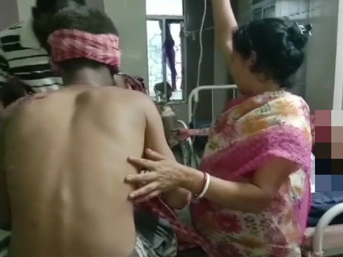 पश्चिम बंगाल में सियासी सरगर्मियों के बीच बम ब्लास्ट, BJP के 6 कार्यकर्ता जख्मी, TMC पर लगाया आरोप