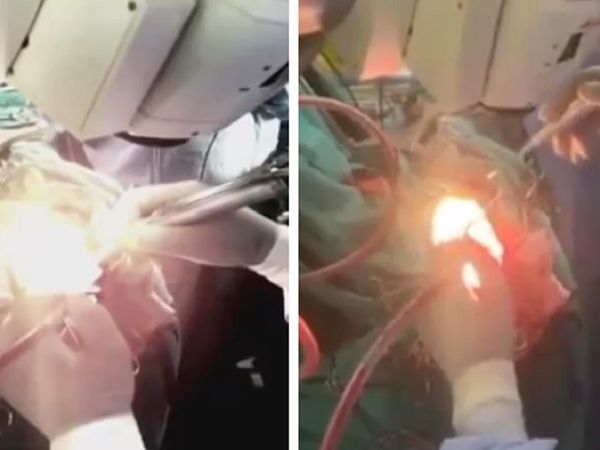 AIIMS में डॉक्‍टर्स का कमाल! बेहोशी के बगैर ब्रेन की सर्जरी, हनुमान चालीसा का पाठ करती रही महिला