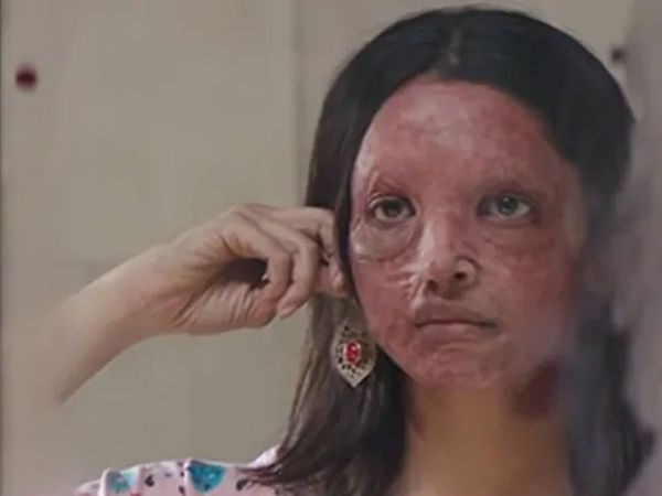 Chhapaak Tax Free In madhya pradesh CM kamal nath official Tweets For Deepika Padukone Film