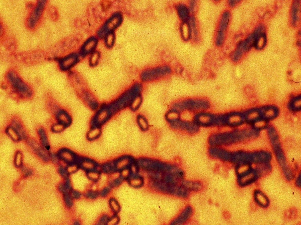 china anthrax: चीन में एंथ्रेक्स निमोनिया की दस्तक, जानें- आखिर क्यों है खतरनाक