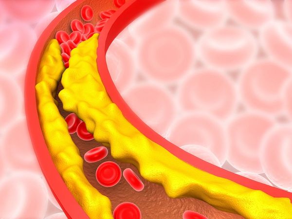 cholesterol, cholesterol tips, cholesterol control tips, cholesterol diet plan, cholesterol control diet plan, cholesterol control diet chart, cholesterol control diet chart, cholesterol reduce tips, cholesterol foods, cholesterol control foods 