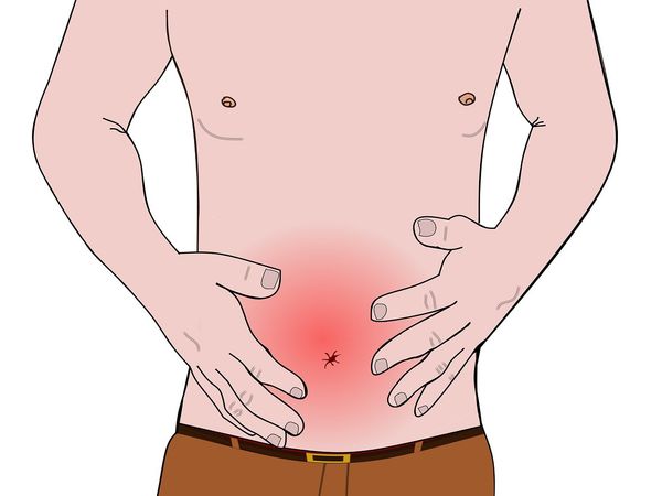 what is colon infection