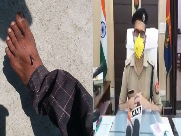 UP cops nailed man's limbs for not wearing mask, police deny all charges