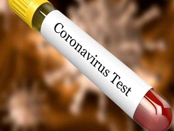 26 new Covid-19 test centers to open in Agra