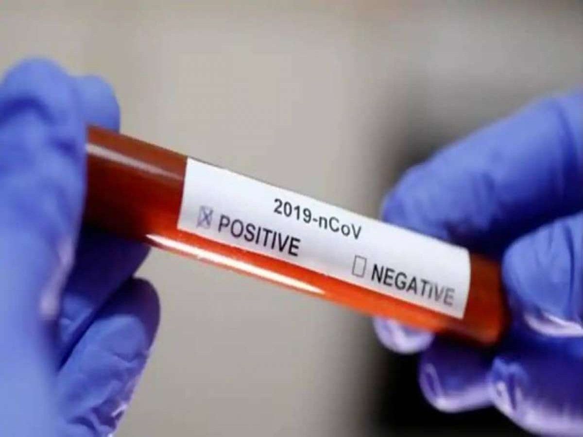 CoronaVirus: कोरोना के कहर से ना परी बची ना कृशु, अस्पताल में जंग लड़ रहा है दिव्यांग पिता