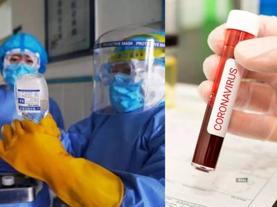 corona virus, death from corona virus, world health organization, corona vaccination corona virus, death from corona virus, world health organization, corona vaccination