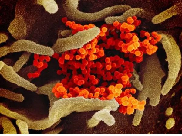 coronavirus microscopic image of deadly virus is out now