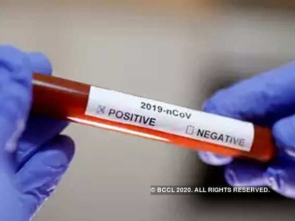 Agra CoronaVirus: ताजनगरी से खुश करने वाली आई खबर, मंगलवार को सिर्फ 6 मामले सामने आए