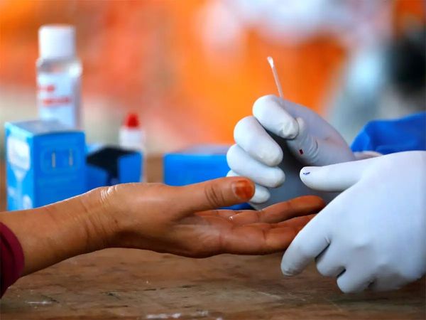 Covid 19 New symptoms: अगर ये आठ लक्षण हों तो ना करें नजरंदाज, टेस्ट जरूर कराएं