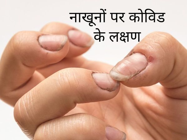 Covid 4th wave  new, Covid 4th wave listest new, Covid 4th wave 2022, cCovid 4th wave in india, symptoms of covid 4th wave in india