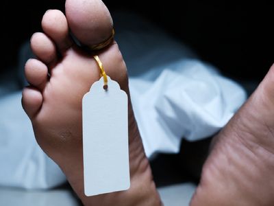 Dead body Dead body