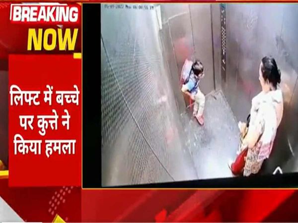 Pet dog bites a child in the lift of the society in Ghaziabad