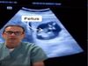 ectopic pregnancy baby discovered inside woman liver in canada 