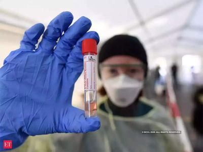 Corona Virus Vs Common Flu Symptoms, How To Know Corona Virus And Flu Symptoms, Difference Between Corona Virus And Common Flu Symptoms, कोरोना वायरस और फ्लू के बीच जानें क्या है अंतर, कैसे पता लगाएं ये कोरोना वायरस है या कॉमन फ्लू, कोरोना वायरस बनाम  कॉम