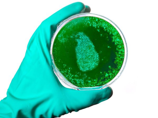 what is Aspergillosis green fungus cases In India Symptoms