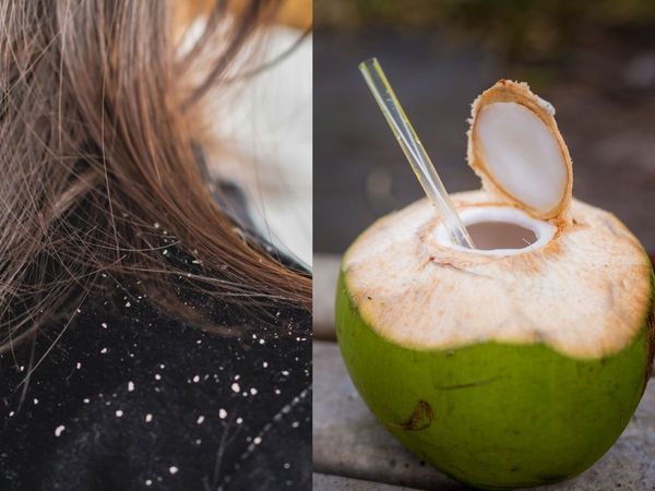 Coconut water benefits for hair