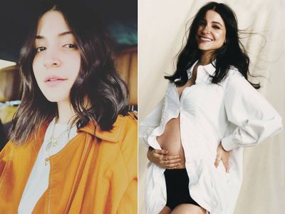 Anushka Sharma face post baby hair fall And Choose New Haircut with help of sonam kapoor Anushka Sharma face post baby hair fall And Choose New Haircut with help of sonam kapoor