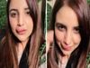 Pakistani TikTok star Hareem Shah displays swollen lip after half done filler procedure Viral Video