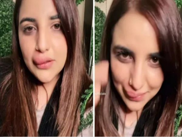Pakistani TikTok star Hareem Shah displays swollen lip after half done filler procedure Viral Video