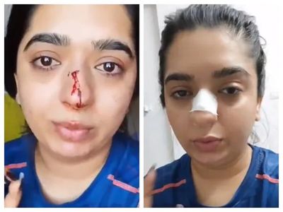 Zomato Case में नया मोड़, डिलिवरी ब्वॉय ने हितेशा चंद्राणी के खिलाफ दर्ज कराया केस Zomato Case में नया मोड़, डिलिवरी ब्वॉय ने हितेशा चंद्राणी के खिलाफ दर्ज कराया केस