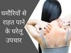 ghamoriya home remedies, how to get rid of ghamoriya quickly, how to get rid of ghamoriya on face, how to get rid of ghamoriya on Body, how to get rid of prickly heat overnight, ghamoriya in babies home remedy, घमौरी दूर करने के घरेलू उपचार,