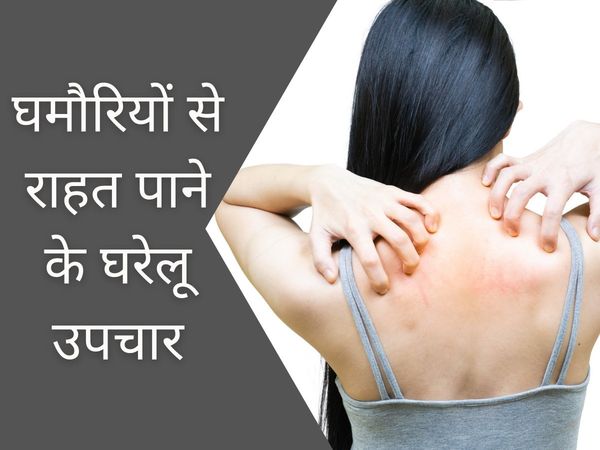 ghamoriya home remedies, how to get rid of ghamoriya quickly, how to get rid of ghamoriya on face, how to get rid of ghamoriya on Body, how to get rid of prickly heat overnight, ghamoriya in babies home remedy, घमौरी दूर करने के घरेलू उपचार,