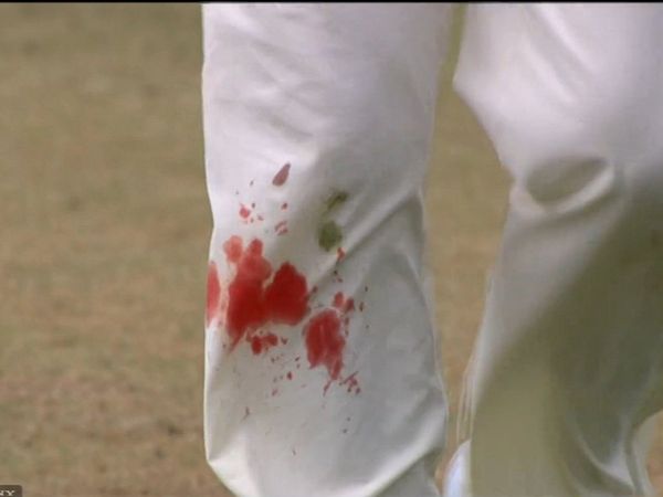 James Anderson Injured Knee