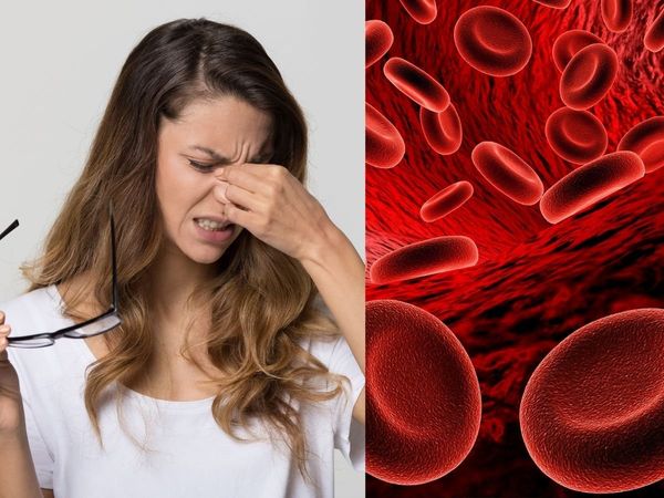 iron deficiency, iron deficiency symptoms 