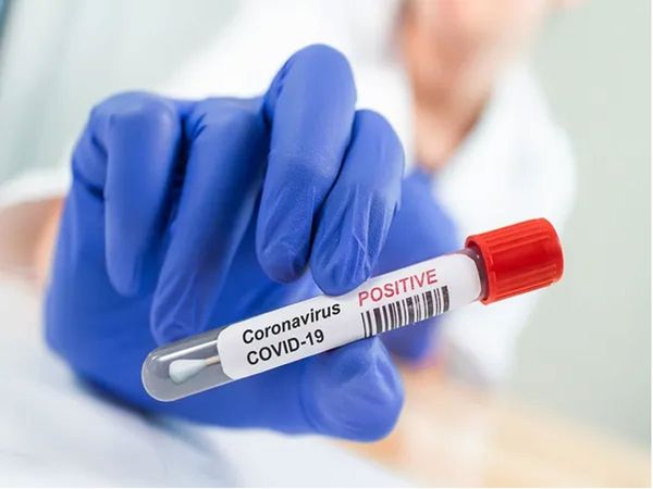 Coronavirus Prevention