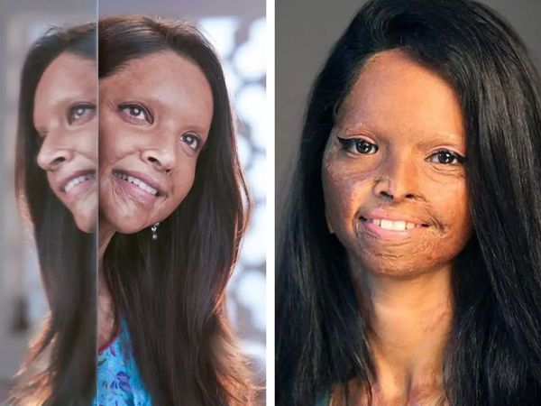 laxmi agarwal chhapaak