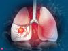 Role of Lungs: शरीर में फेफड़ों की क्या भूमिका होती है, शरीर को मिलनेवाले ऑक्सीजन से यह कैसे जुड़ा है