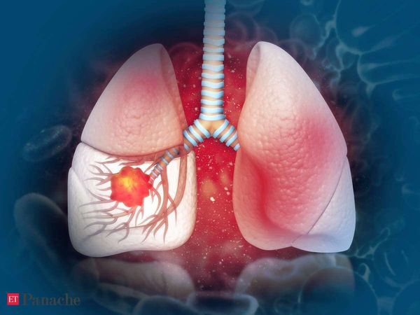Role of Lungs: शरीर में फेफड़ों की क्या भूमिका होती है, शरीर को मिलनेवाले ऑक्सीजन से यह कैसे जुड़ा है